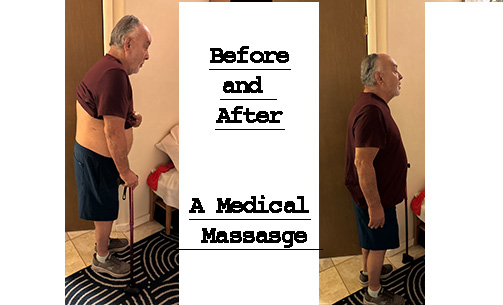 Example of improved posture after a medical massage